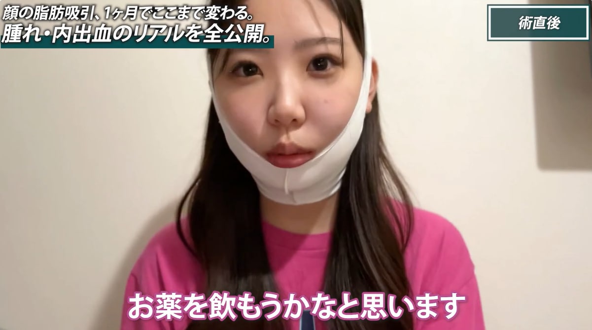 Q. 痛み止めはいつまで飲んだ？