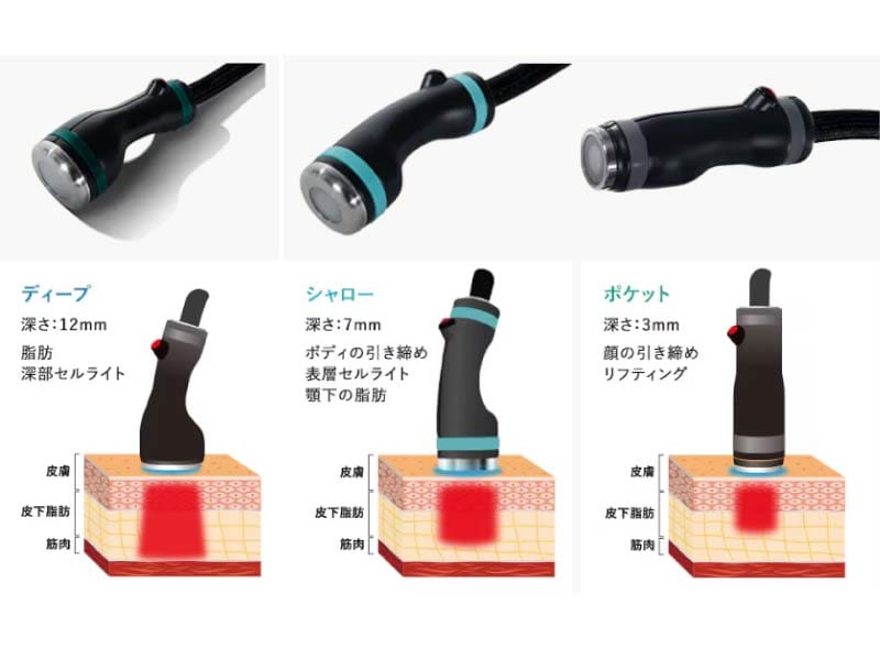 3つのハンドピースで顔から体まで全方位アプローチ