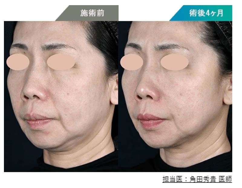 驚異の症例実績と、常に進化する独自の照射マニュアル