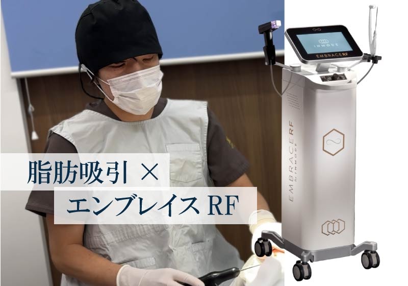 1. 脂肪吸引とタイトニング(引き締め)の組み合わせ