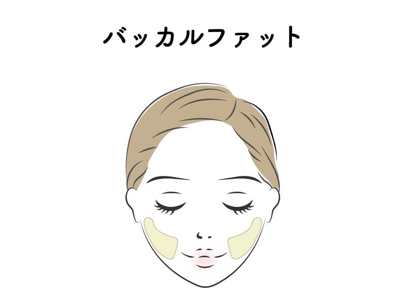 バッカルファットとは