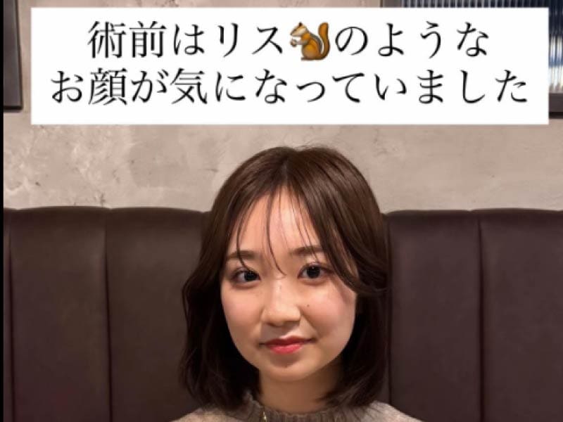 バッカルファットがあると...