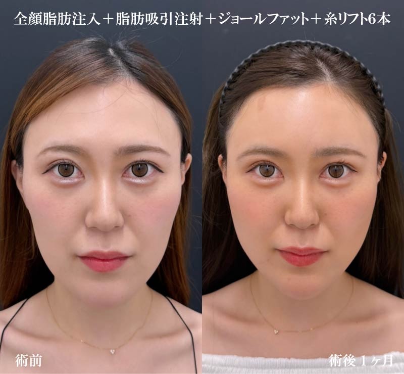 20代女性