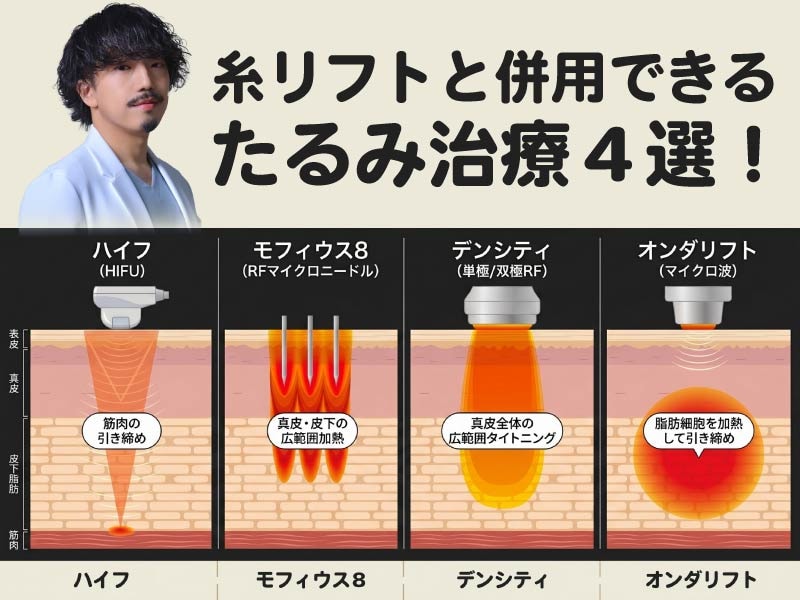 【川崎】糸リフトと併用できるおすすめたるみ治療4選!ハイフ・モフィウス8・デンシティ・オンダリフト徹底比較