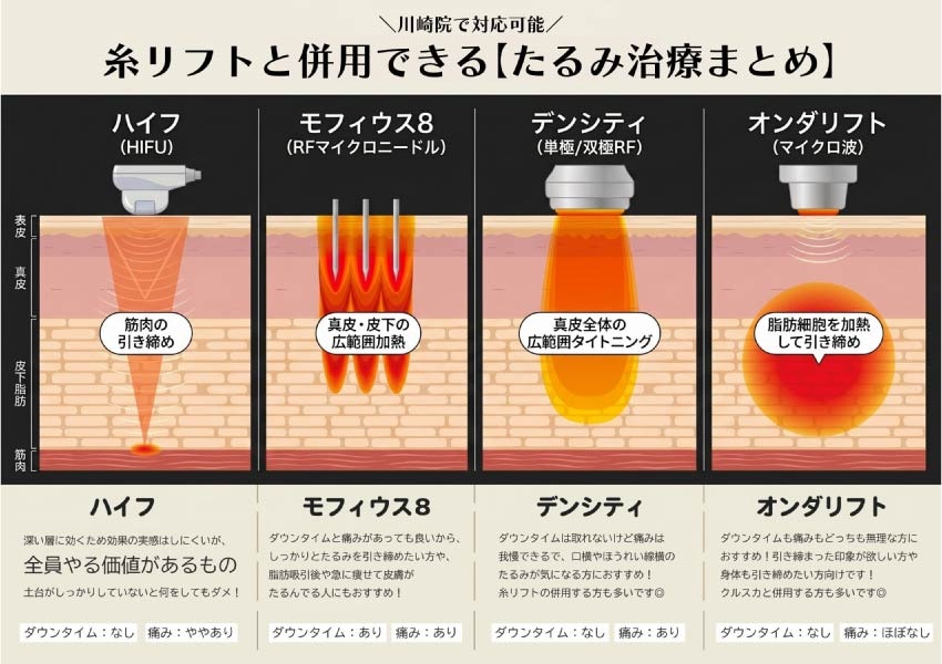 【比較表】ハイフ・モフィウス8・デンシティ・オンダリフトの違い