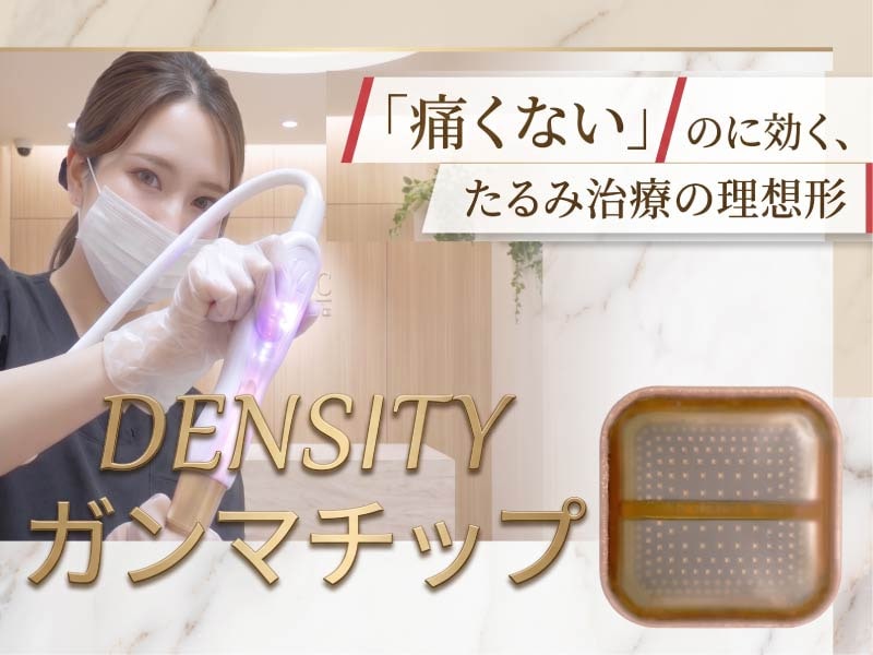 口横ポニョ・顎下に効く!痛くない最新たるみ治療「デンシティ ガンマ」の効果と進化の秘密