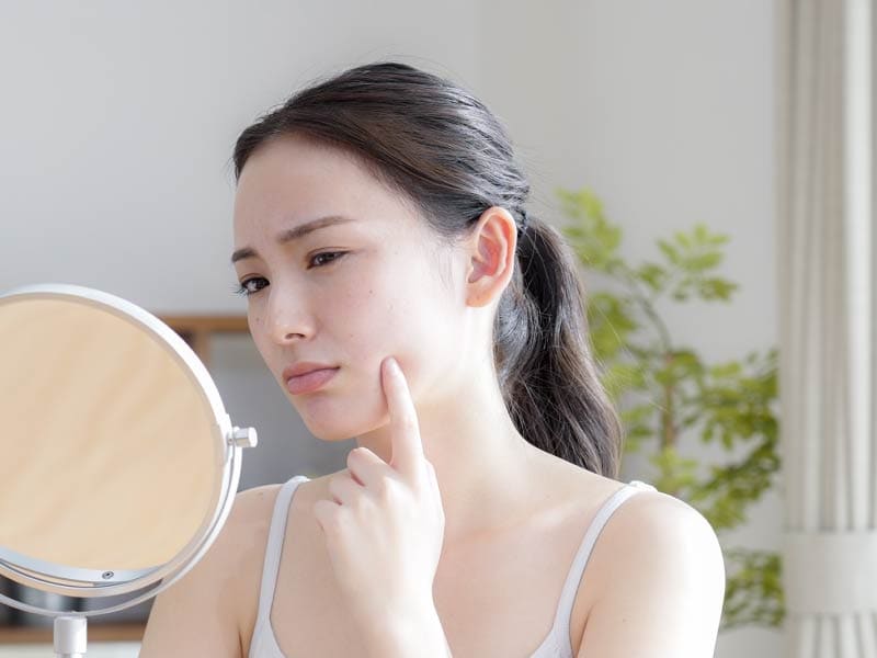 市販薬（塗り薬）やニキビ漢方で効果を感じにくい理由