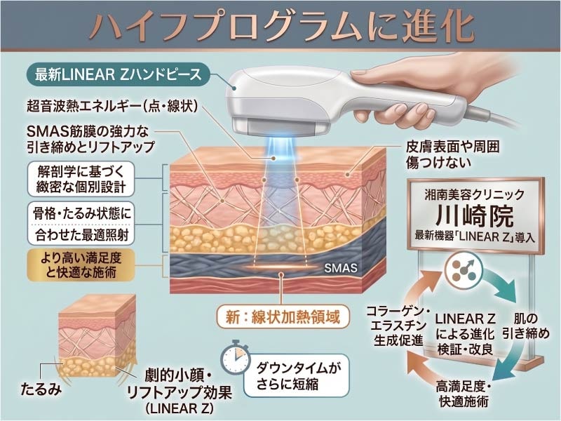 最新機器「LINEAR Z」導入によるSBCハイフプログラムの進化