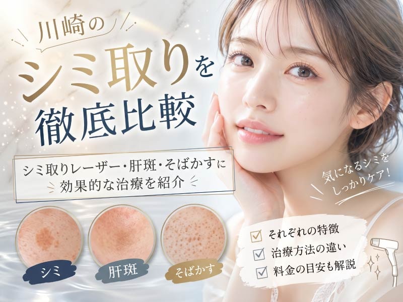 川崎のシミ取りを徹底比較|シミ取りレーザー・肝斑・そばかす