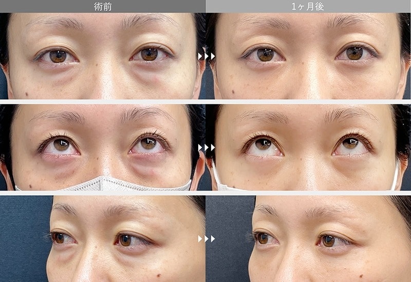 30代