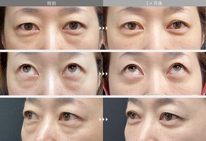 40代