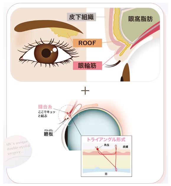 自然癒着法ってそもそも何?
