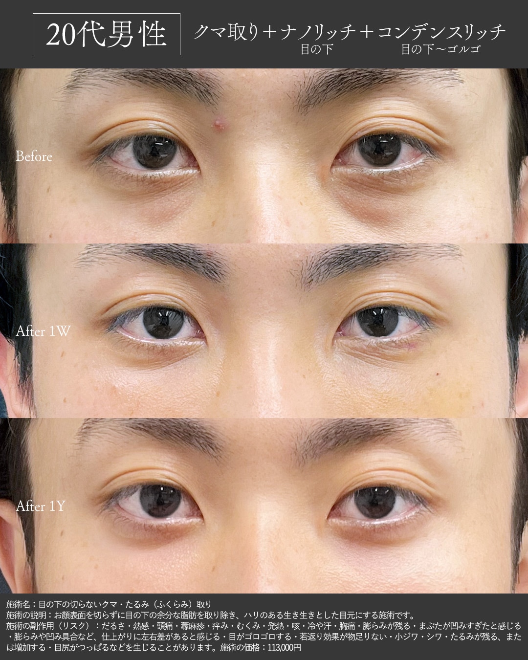 20代男性