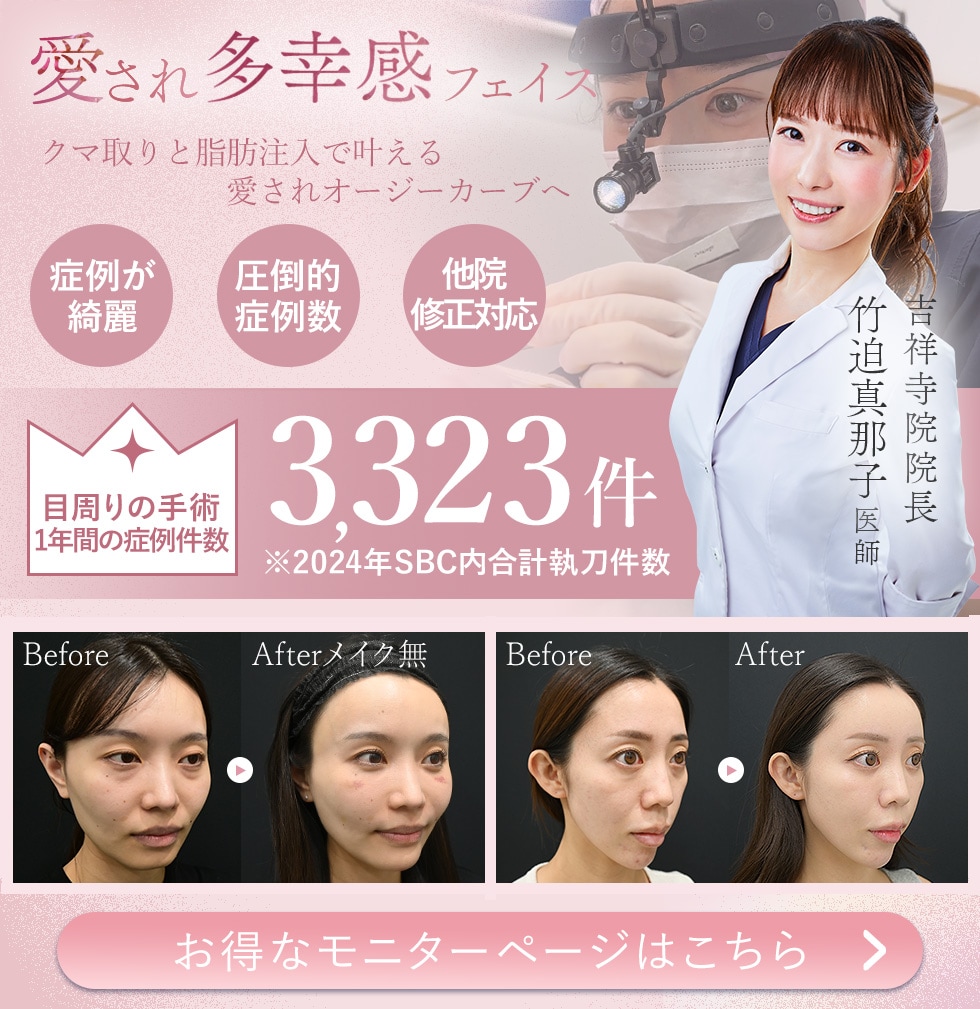 目の下の切らないクマ・たるみ取り、脂肪注入、裏ハムラ、切開ハムラ、表ハムラ、アイバックリムーブ