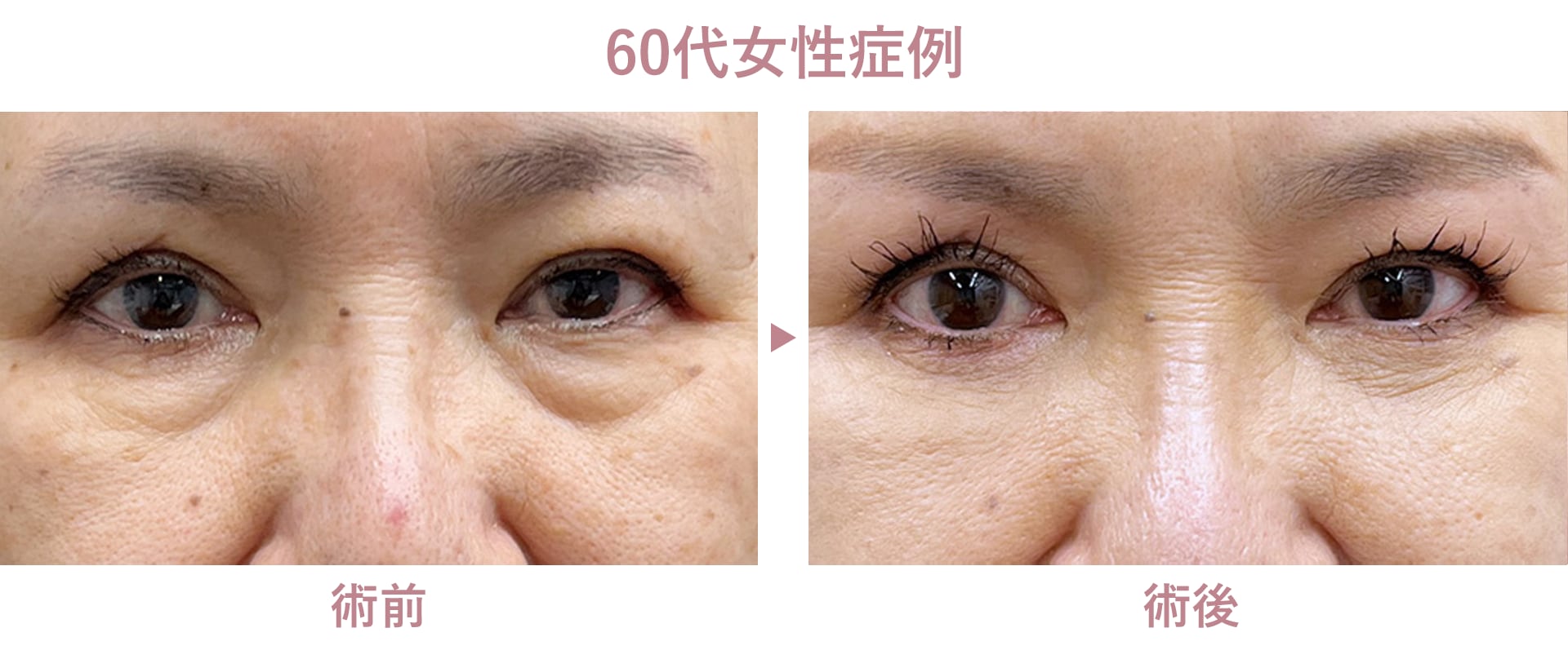 60代女性