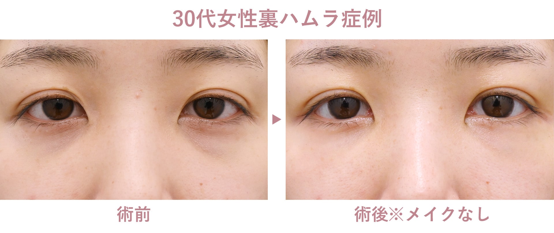 30代女性裏ハムラ