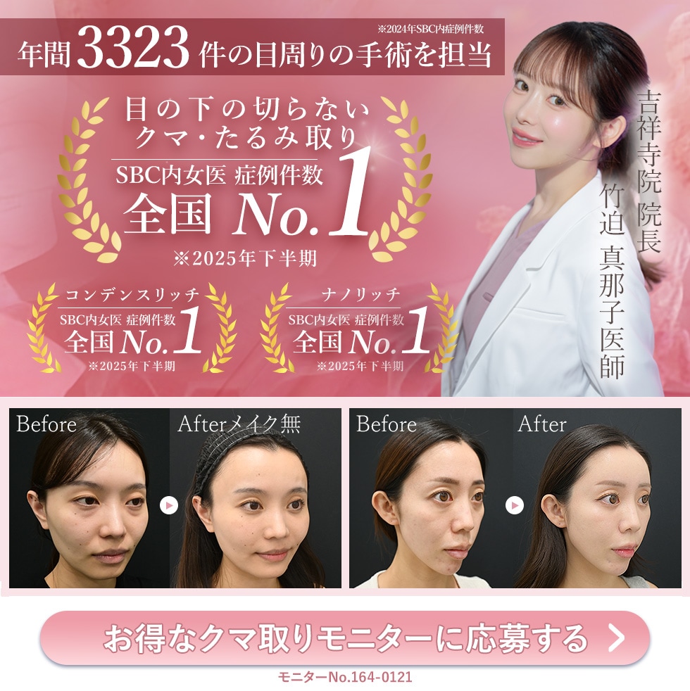 目の下の切らないクマ・たるみ取り　脂肪注入　裏ハムラ　切開ハムラ　表ハムラ　アイバックリムーブ　クマ取り 