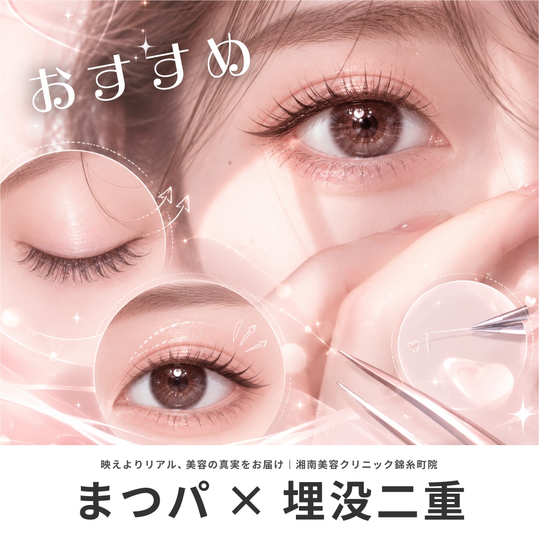 【まつパ×埋没二重デザイン】東京で人気の二重整形(埋没二重)|湘南美容クリニック錦糸町院