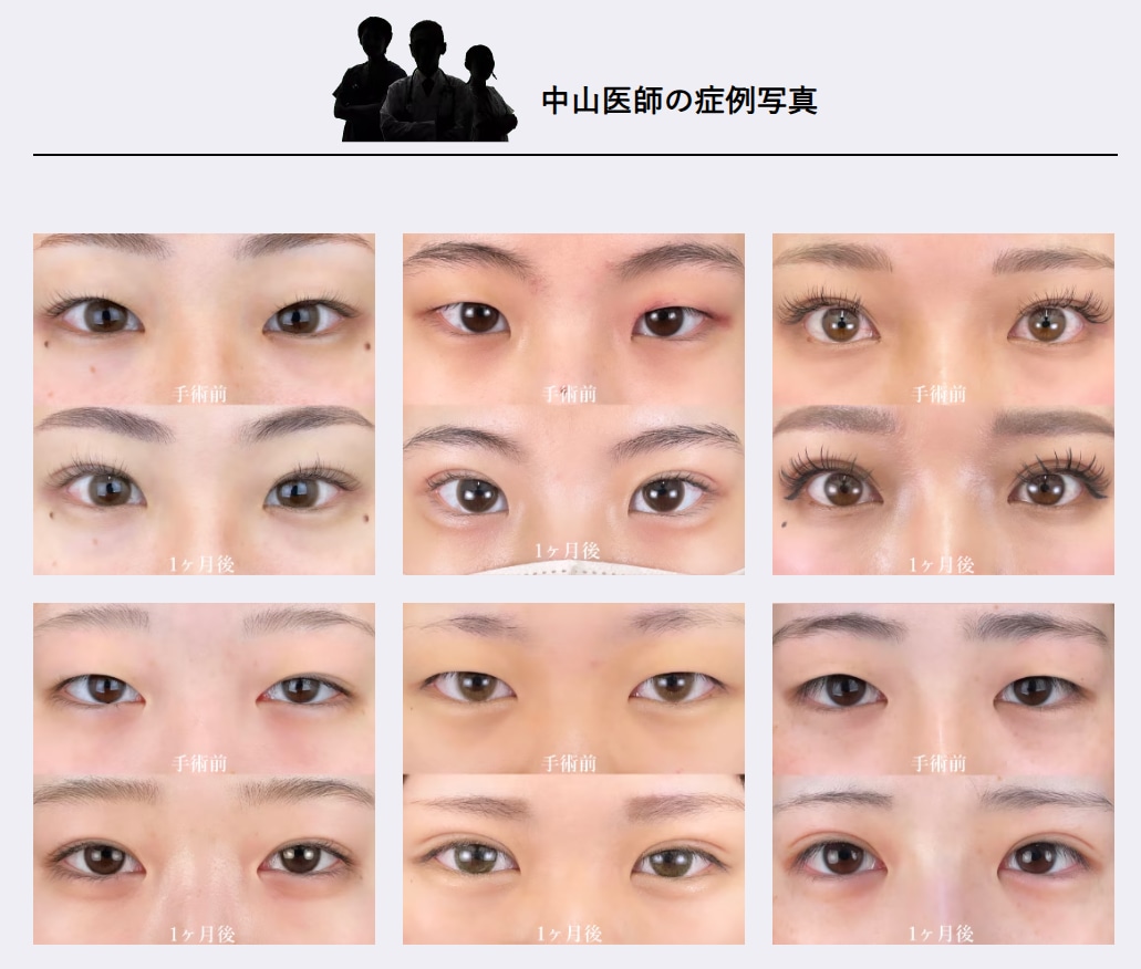 クイックコスメティーク・ダブル Neoの症例写真