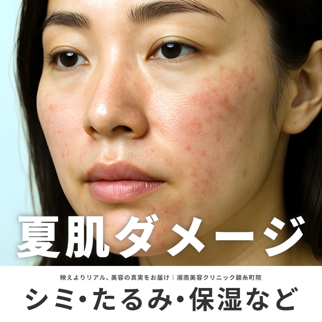夏の紫外線や乾燥でダメージを受けた肌をリセット！｜シミ・たるみ予防は湘南美容クリニック錦糸町院