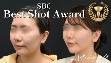 プロの美容ドクターも認める！BEST SHOT AWARD