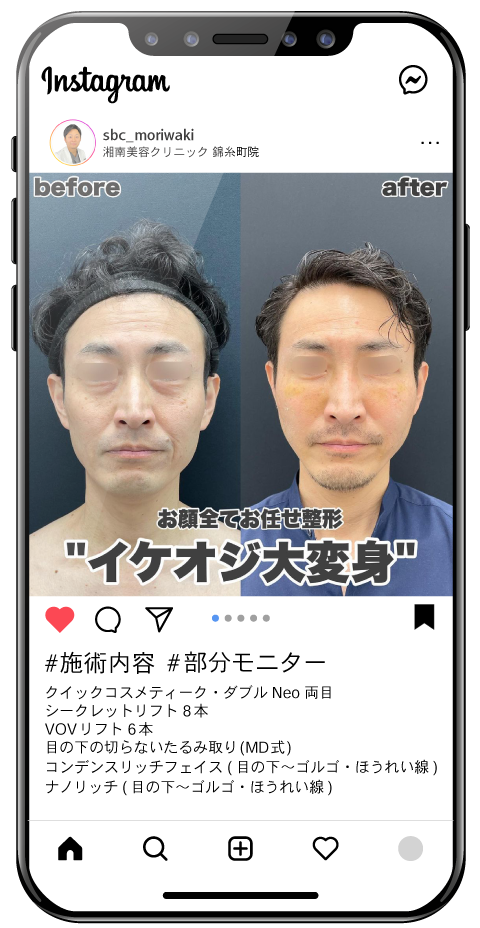 見た目が変われば、意識が変わる。<br />
40代男性複合手術
