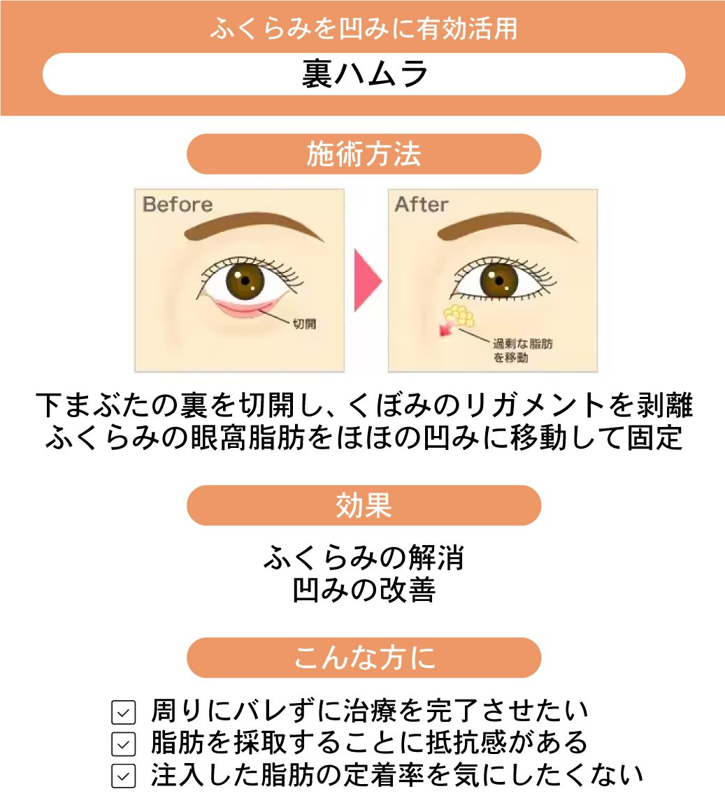 ドクターの技術力が必要 