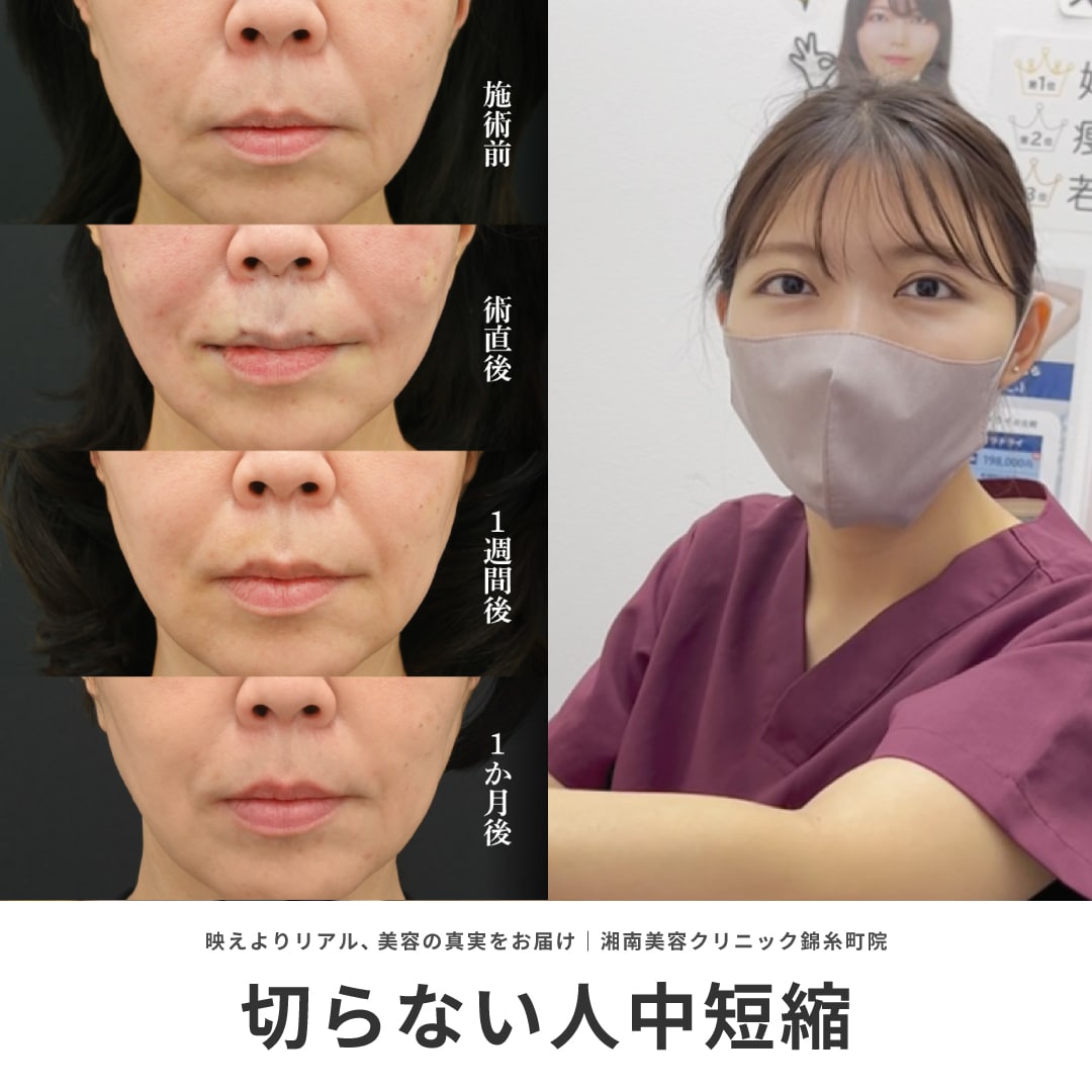 錦糸町院で切らない人中短縮