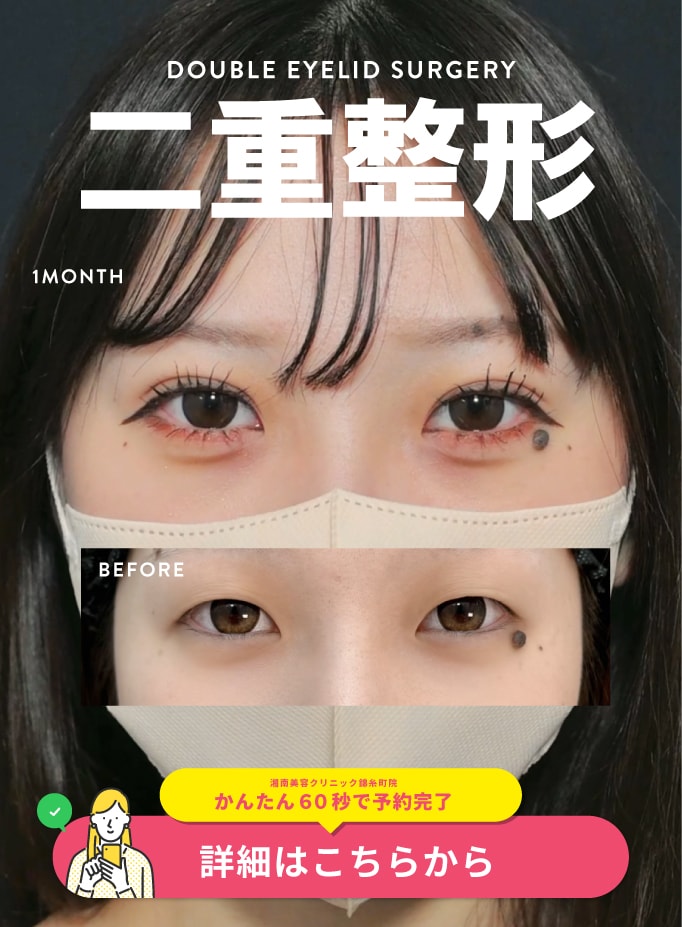 【二重術】男女募集中！ナチュラル変化は中山院長にお任せください！