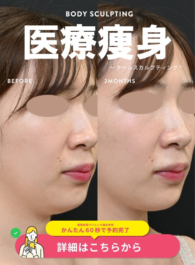 【痩身治療】錦糸町院痩身プログラム
