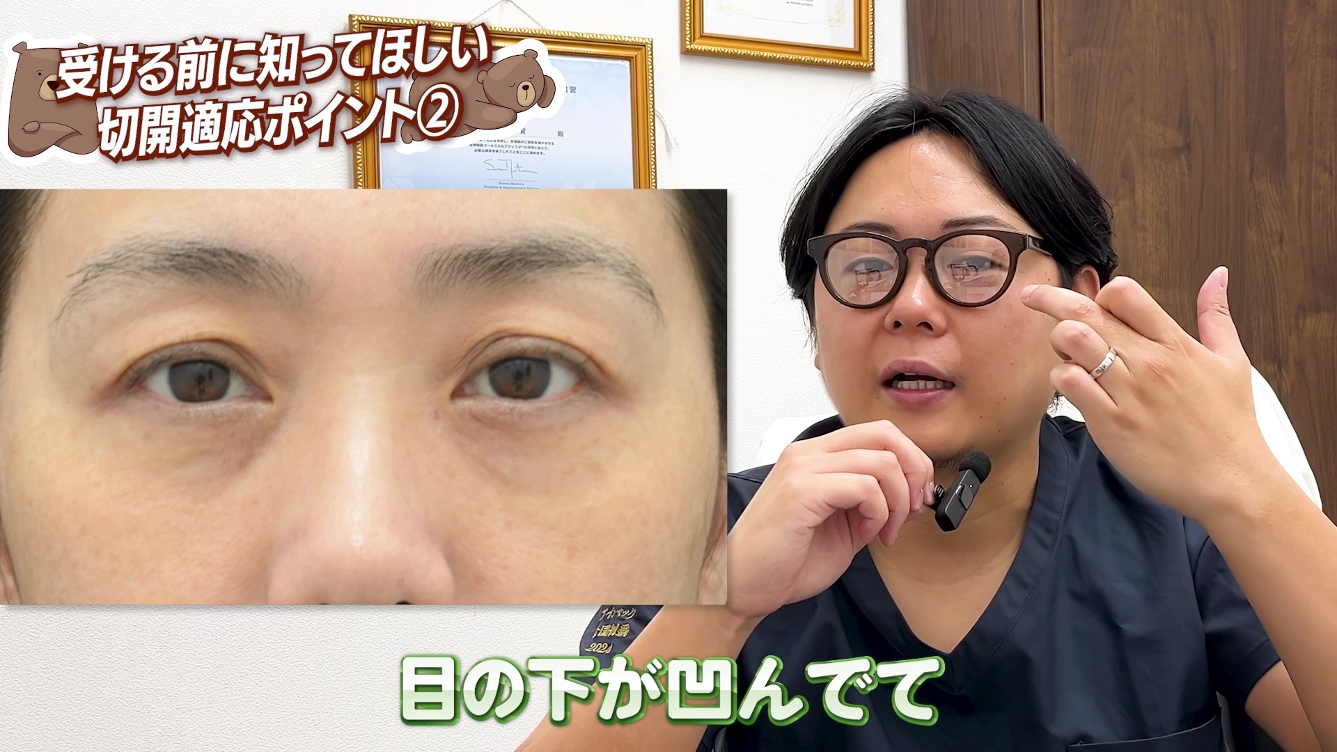 ✅② クマはあるけど膨らみがない方