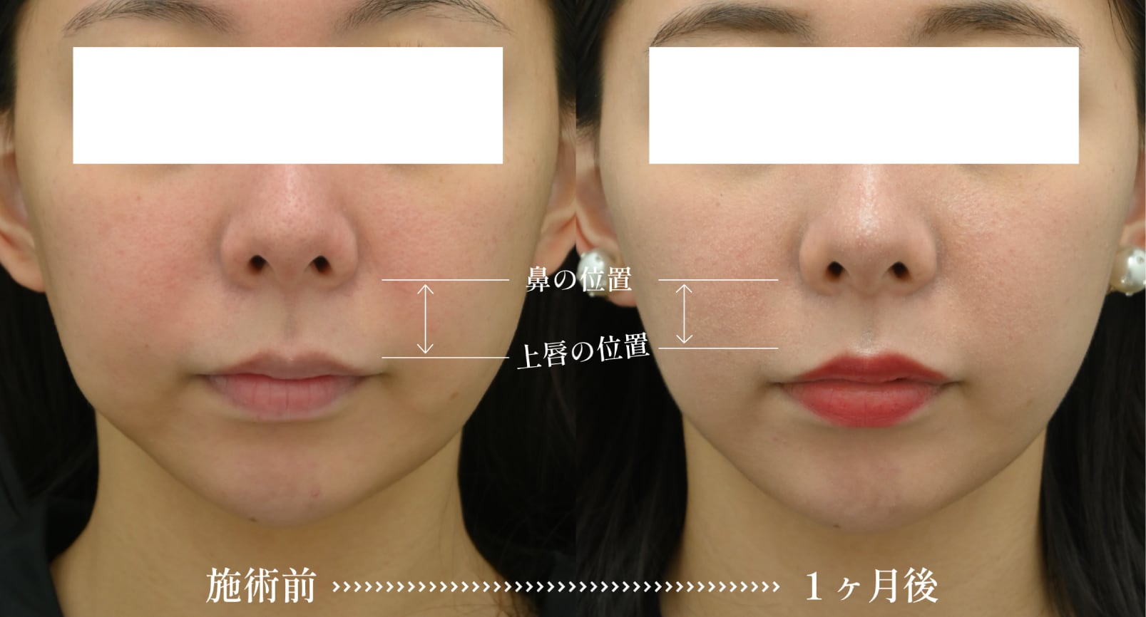 【30代女性の症例】