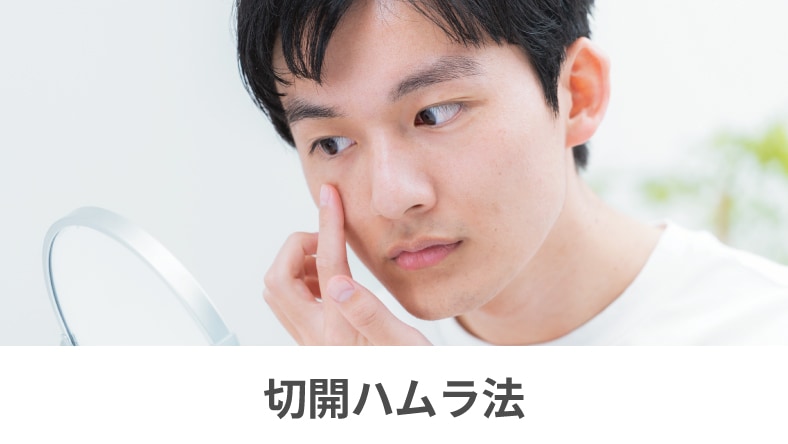 切開ハムラ法(皮膚のたるみも改善)
