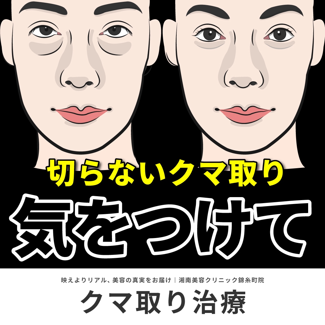 目の下の切らないクマ・たるみ（ふくらみ）取りの落とし穴｜年齢・タイプ別解説