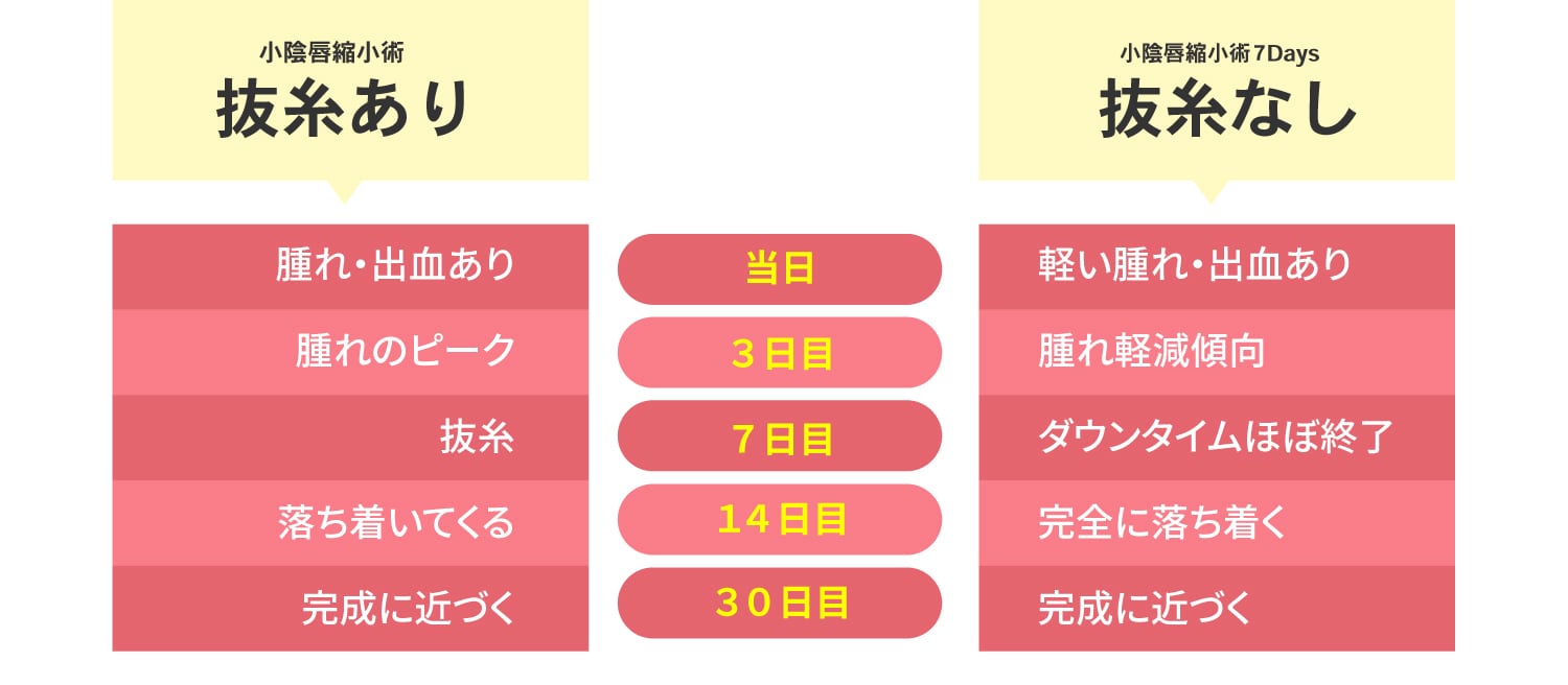 小陰唇縮小術のダウンタイム比較