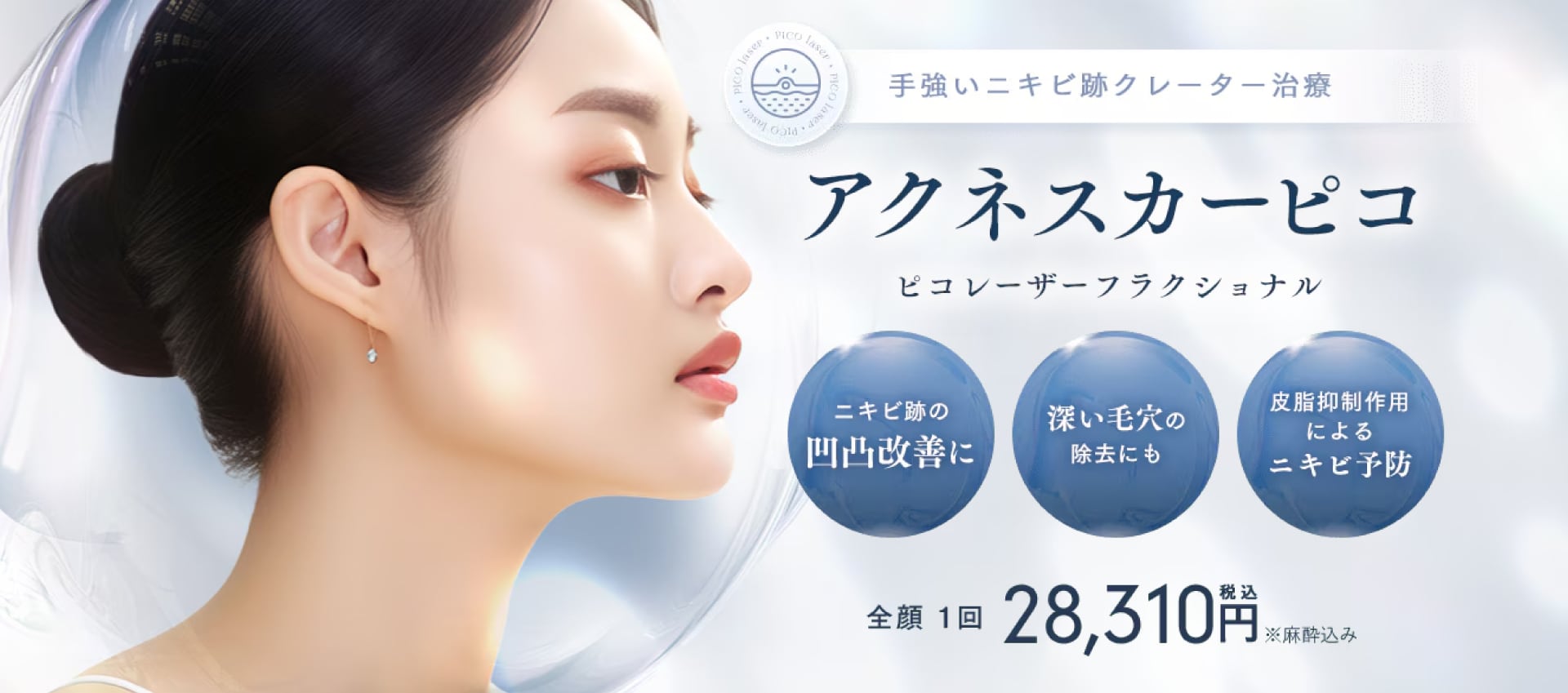 4. アクネスカーピコ