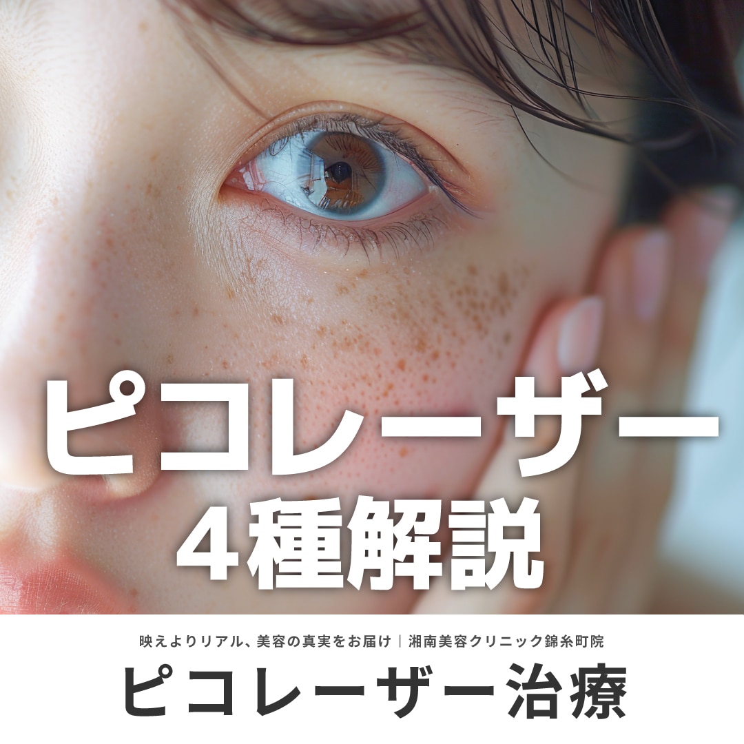 毛穴・ニキビ跡・くすみ改善に！今注目の「ピコレーザー」治療まとめ｜湘南美容クリニック錦糸町院