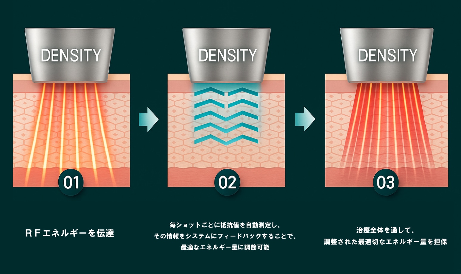 最先端の高周波リフトアップ技術