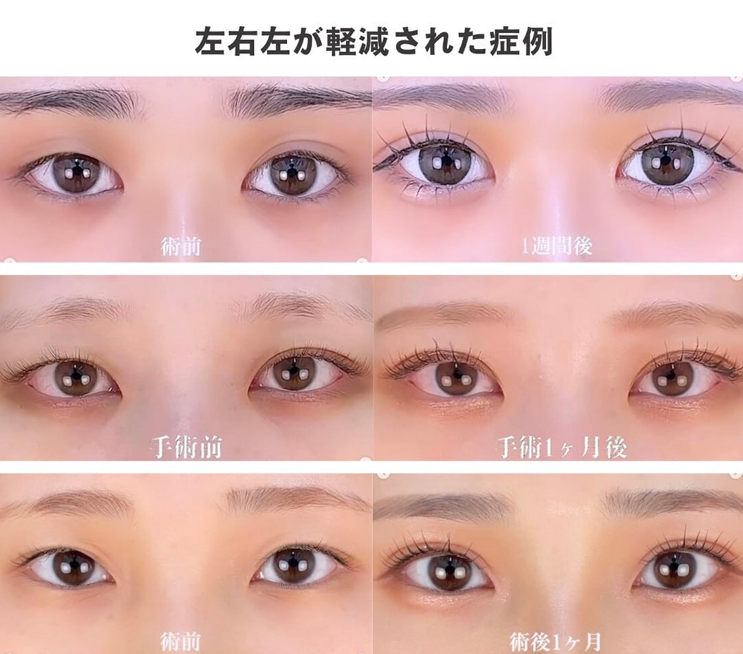 左右差を整える圧倒的デザイン力