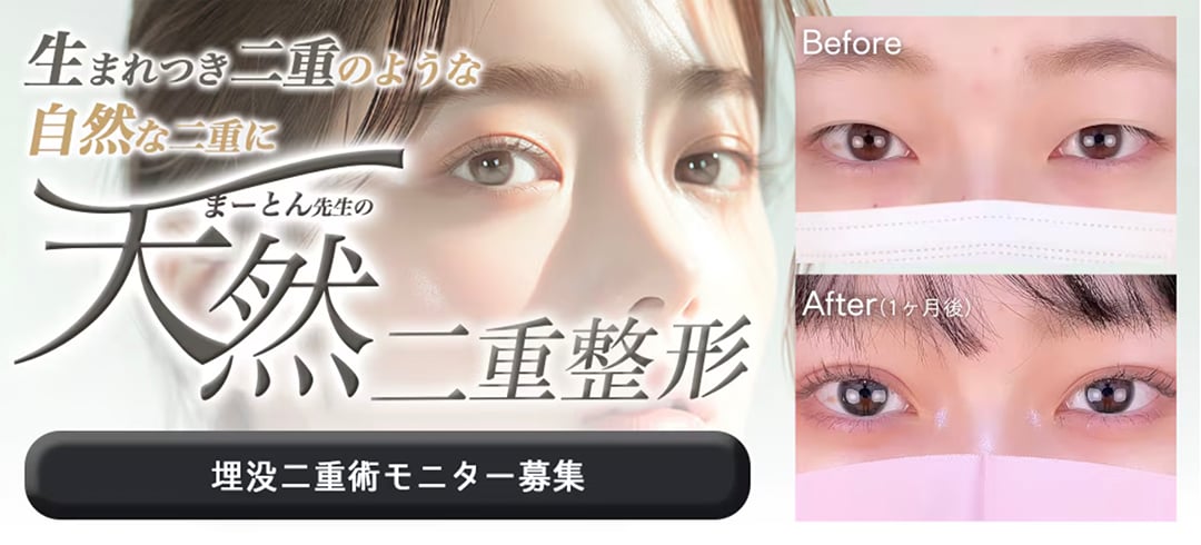 圧倒的美しさ『天然二重整形』の秘密