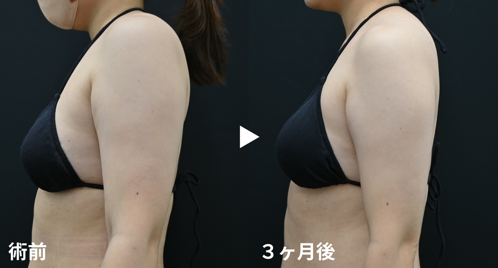 全身本気やせプラン