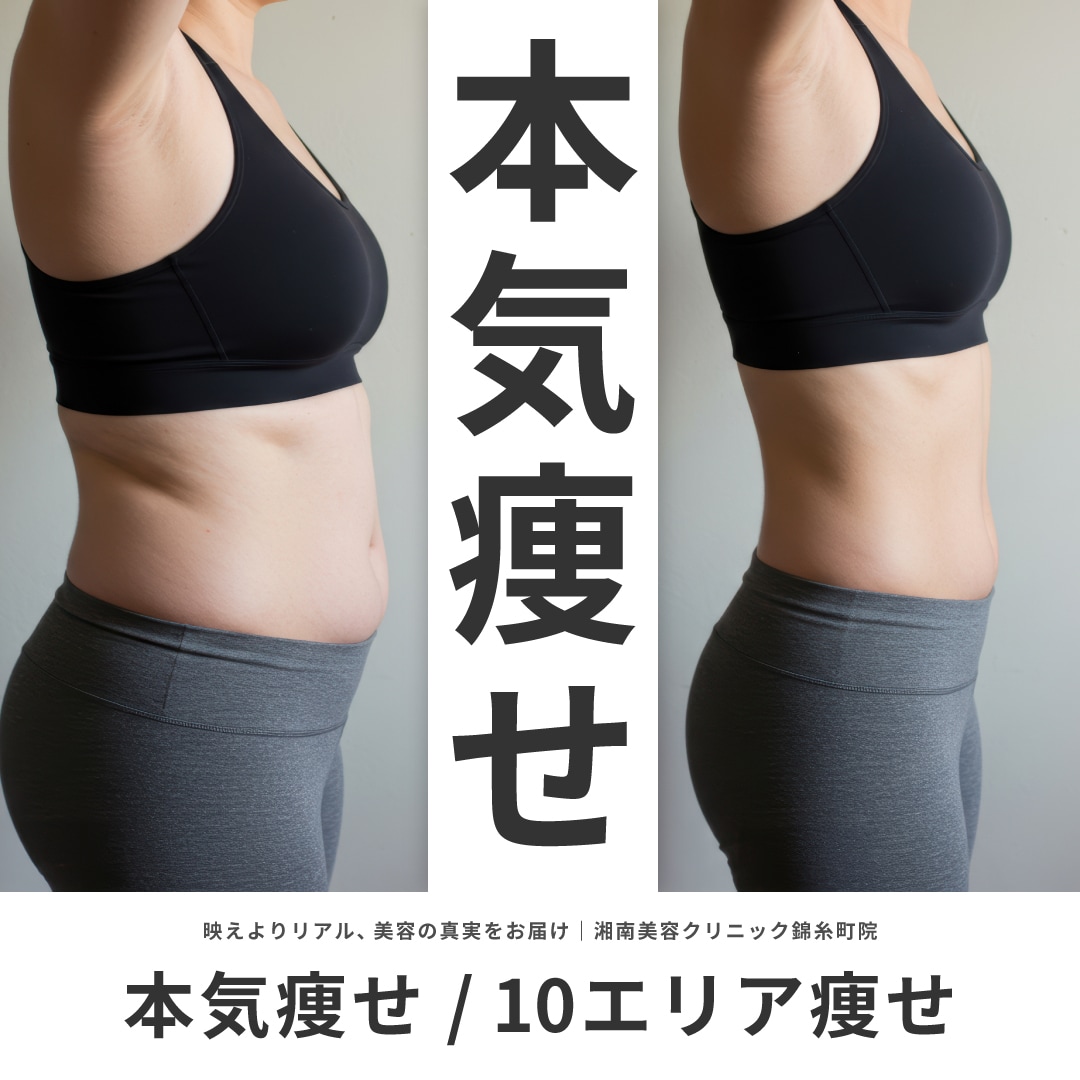 本気痩せ！10エリア痩せ！【クールスカルプティング】で手術なしの痩身治療を｜湘南美容クリニック