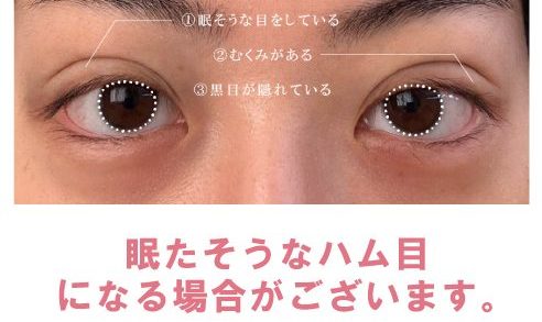 埋没法だけで行うと、眠そうなハム目になる可能性があるという解説画像