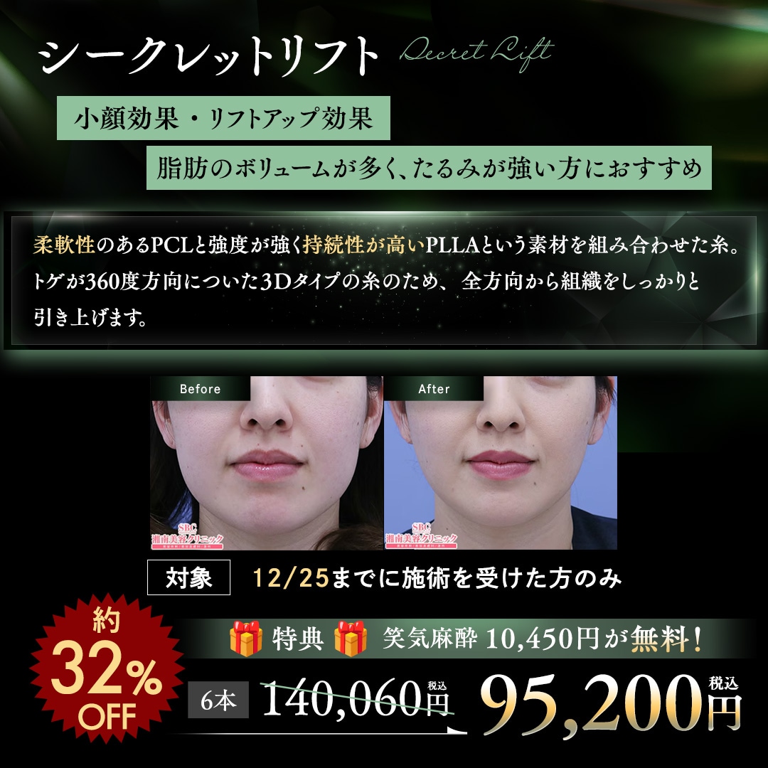 シークレットリフト