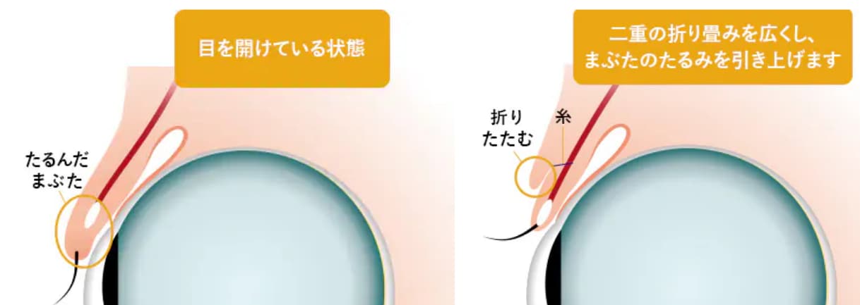 【施術のイメージ】