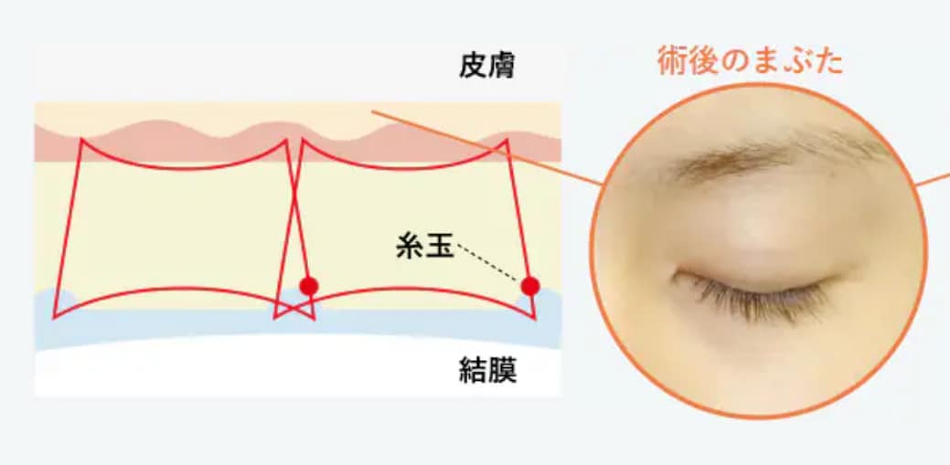 ＜クイックコスメティーク・ダブルNEOの特長＞