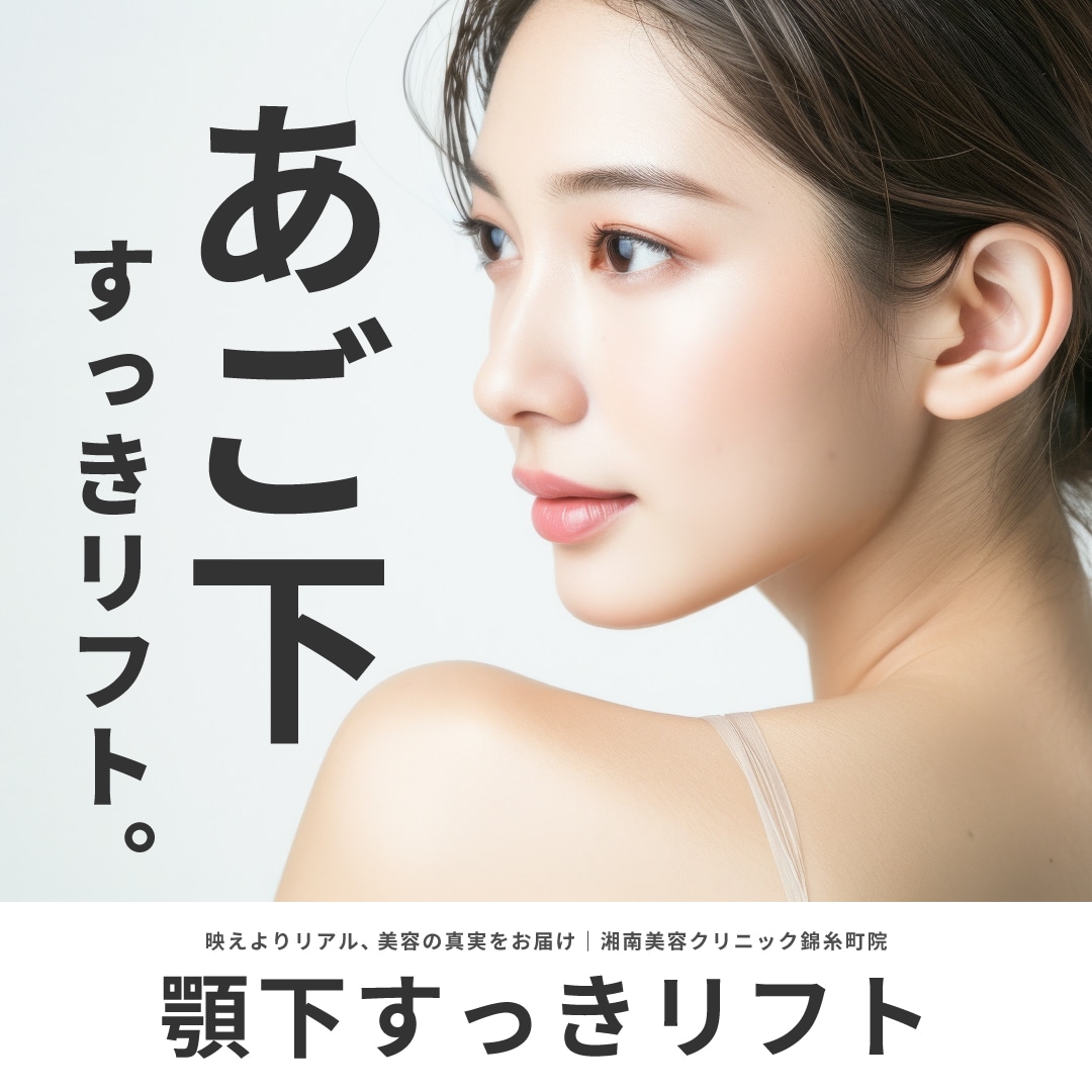顎下すっきリフト（アンカーDXダブル）で二重顎・顎下のたるみを徹底改善｜湘南美容クリニック錦糸町院