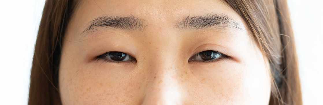 まずはセルフチェック！