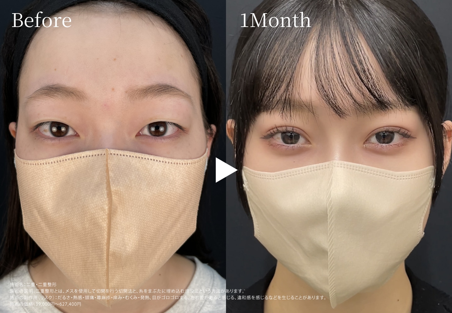 ド派手デザイン