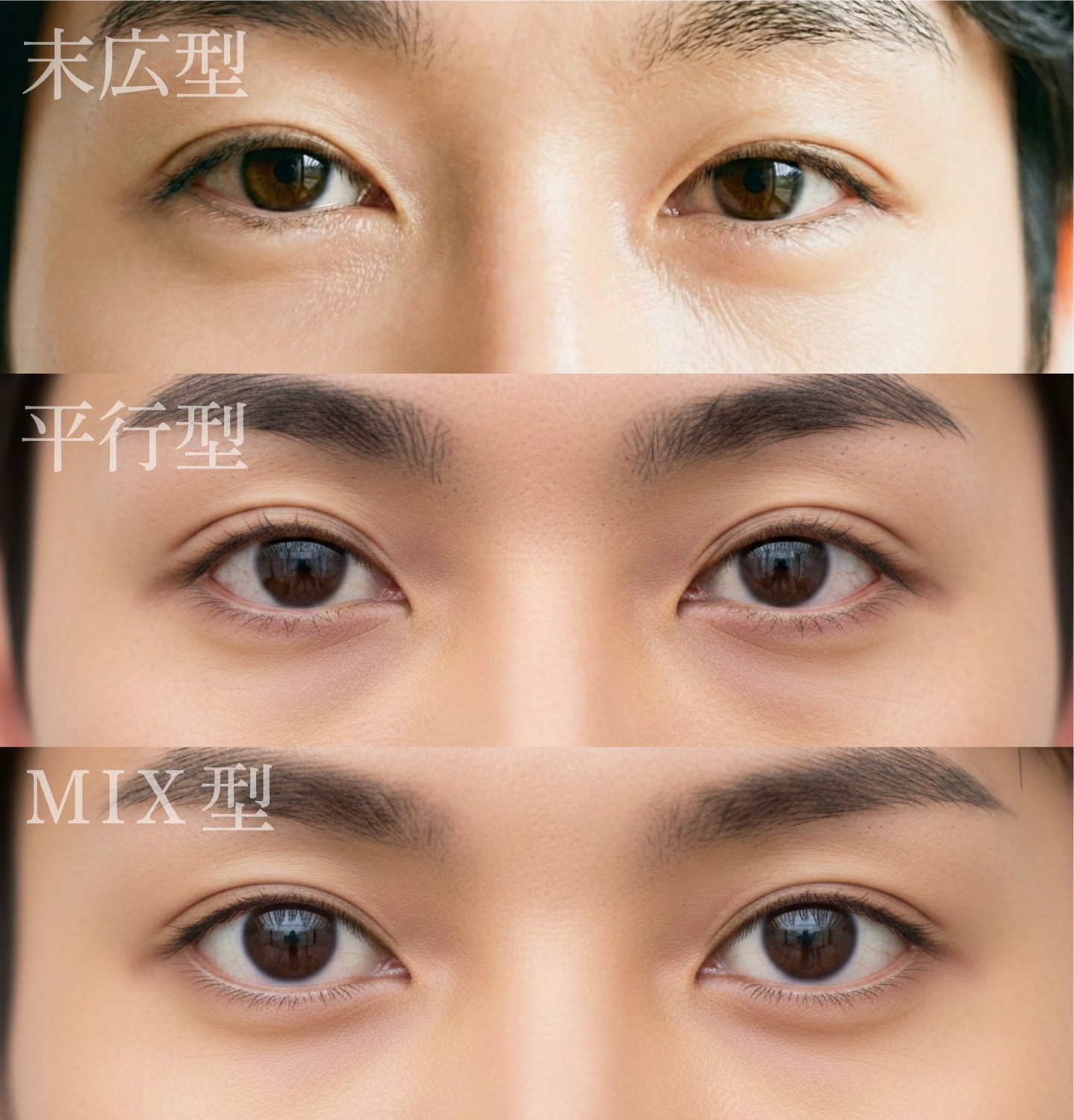 なりたい顔の雰囲気によって、おすすめの二重デザインは変わります！